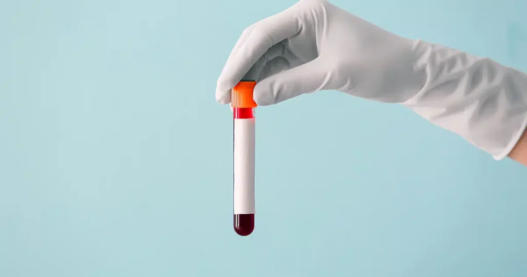 blood sample